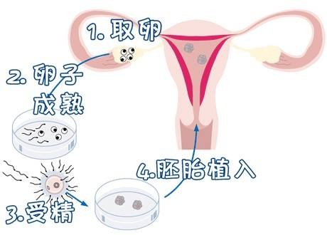 培养箱